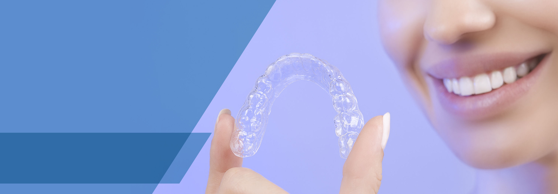Blanqueamiento dental con cubetas. Aclara de 4 a 8 tonos