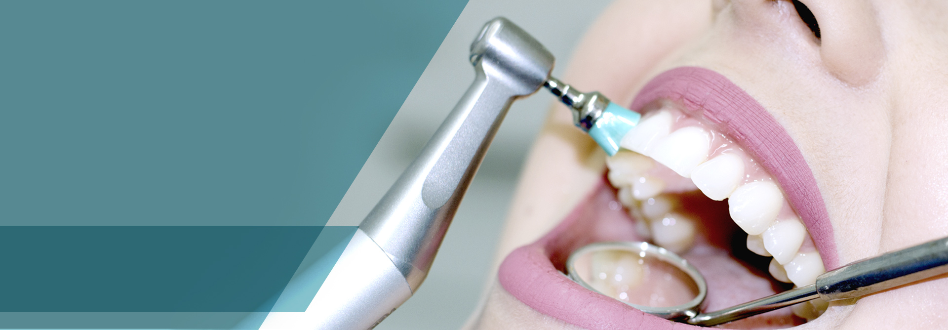 Limpieza dental + Desmanchado por solo