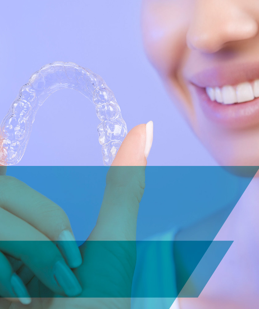 Blanqueamiento dental con cubetas. Aclara de 4 a 8 tonos