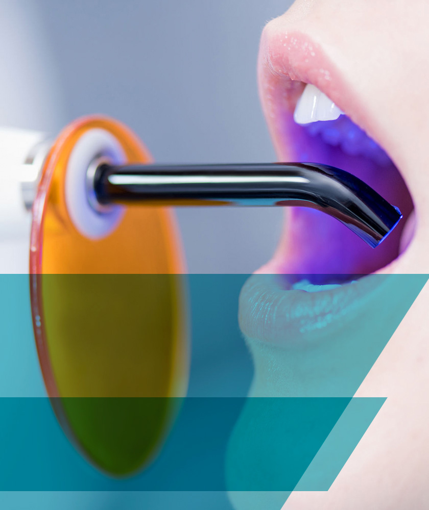 Restauraciones esteticas